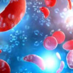 Fulcrum's Stock Plummets as Muscle Disorder Drug Fails in Late-Stage Study