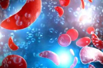 Fulcrum's Stock Plummets as Muscle Disorder Drug Fails in Late-Stage Study