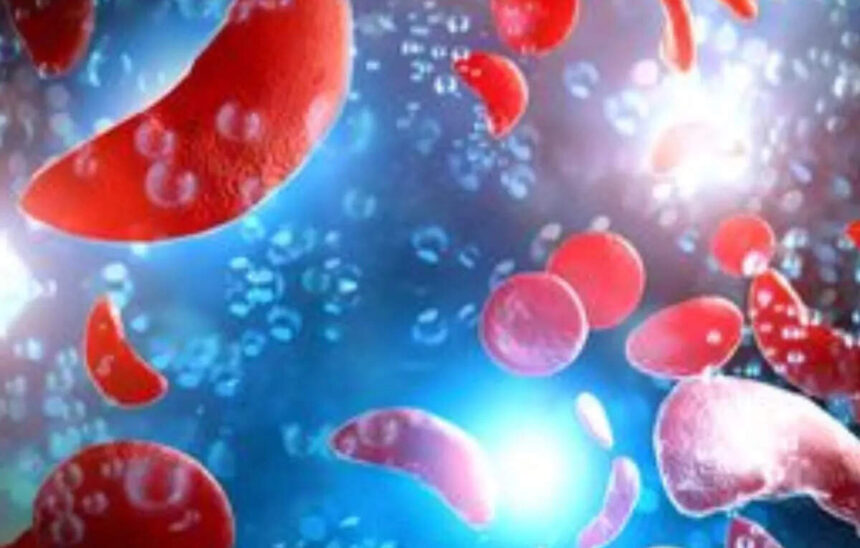 Fulcrum's Stock Plummets as Muscle Disorder Drug Fails in Late-Stage Study