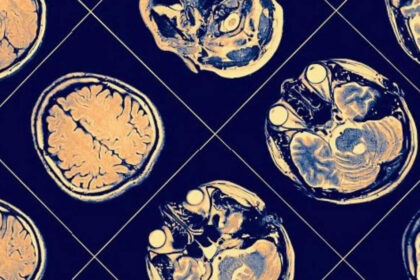 Neurocrine Halts Schizophrenia Drug Development Trial Due to Failure