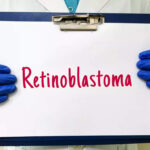 AIIMS Launches Gamma Knife Treatment for Retinoblastoma