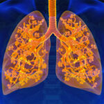 H. N. Reliance Foundation Hospital Launches Clinic for Respiratory Diseases, Reports ET HealthWorld