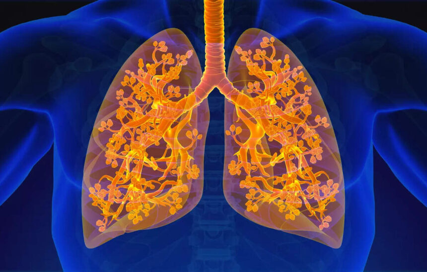 H. N. Reliance Foundation Hospital Launches Clinic for Respiratory Diseases, Reports ET HealthWorld