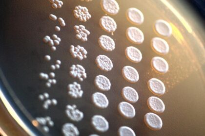 Yeast Mutated to Develop Brain Defects: A Curious Case