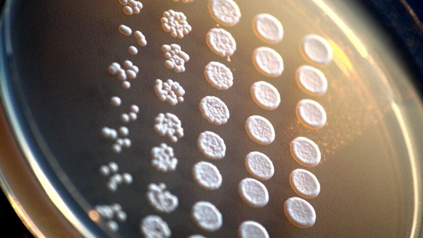 Yeast Mutated to Develop Brain Defects: A Curious Case