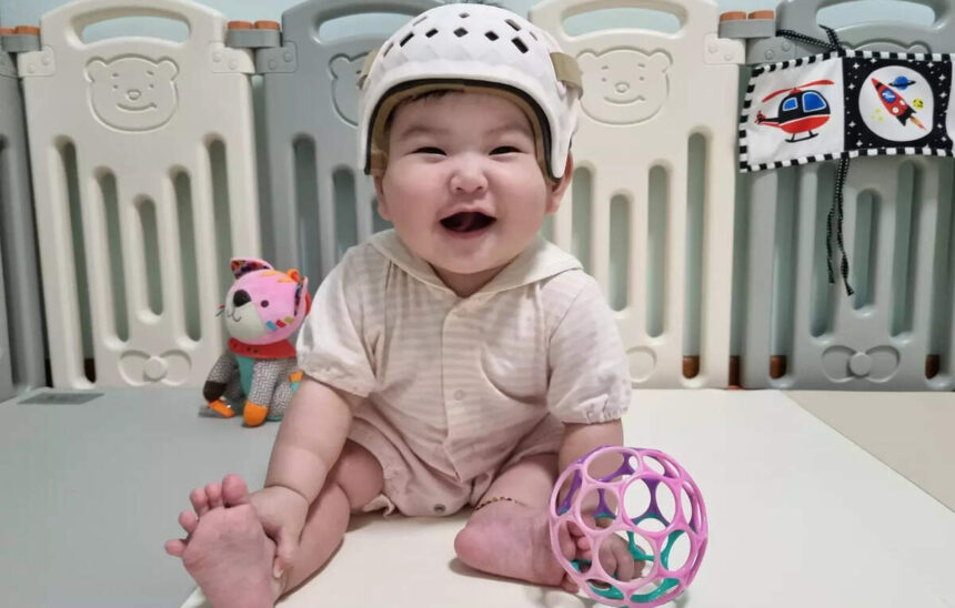 KKH Launches Free Clinic for Treating Flat Head Syndrome