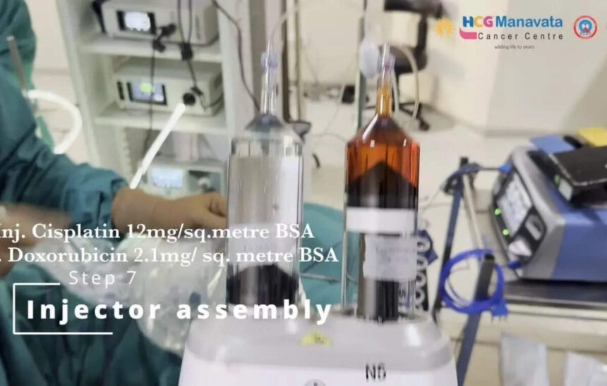 Manavata Cancer Centre Conducts First PIPAC Procedure for Advanced Abdominal Cancer, Healthcare News Leads Report