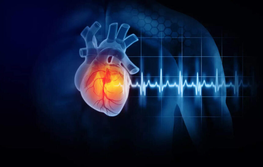 STEMI Program Unveiled to Combat Heart Disease Mortality in UP